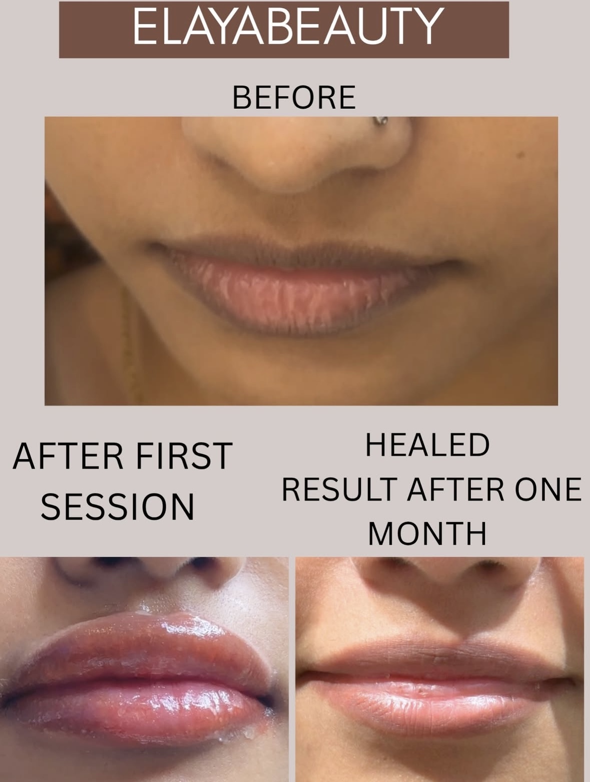 Before, after first session and healed one-month photos of a semi-permanent lip colour treatment